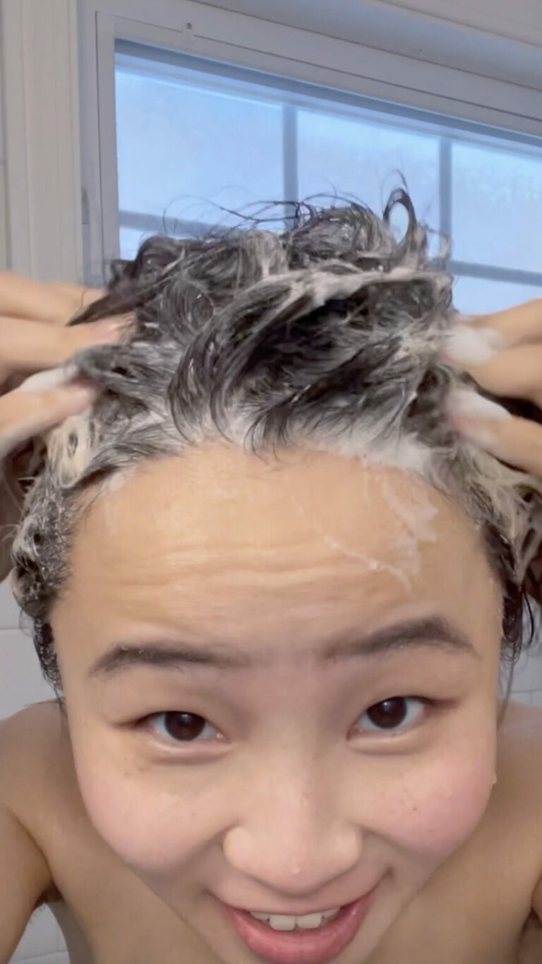 Zero Flakes Given: My Go-To Hack For Dandruff And Dry Scalp Issues
